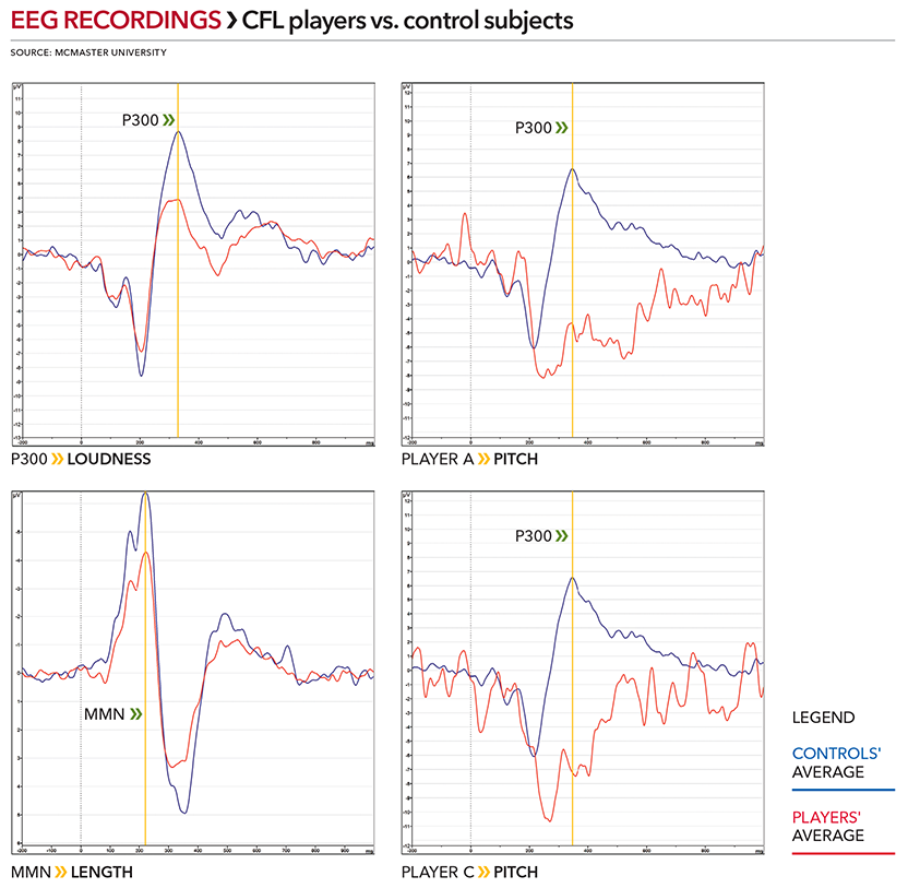 Hamilton study EEG recordings.