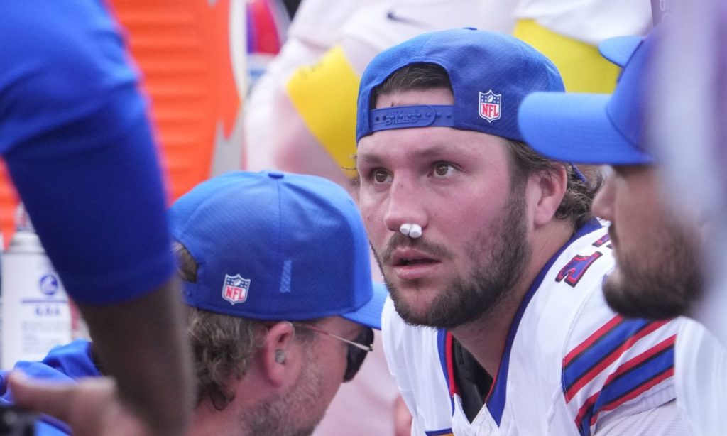 Tony Romo was shook by Josh Allen’s bloody nose